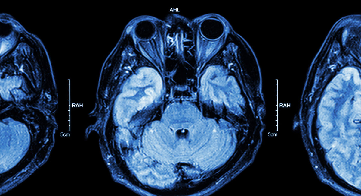 Spine and Neurosurgery Center